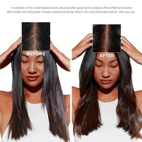Symbiose Pureté Anti-Dandruff Shampoo for Oily Scalp